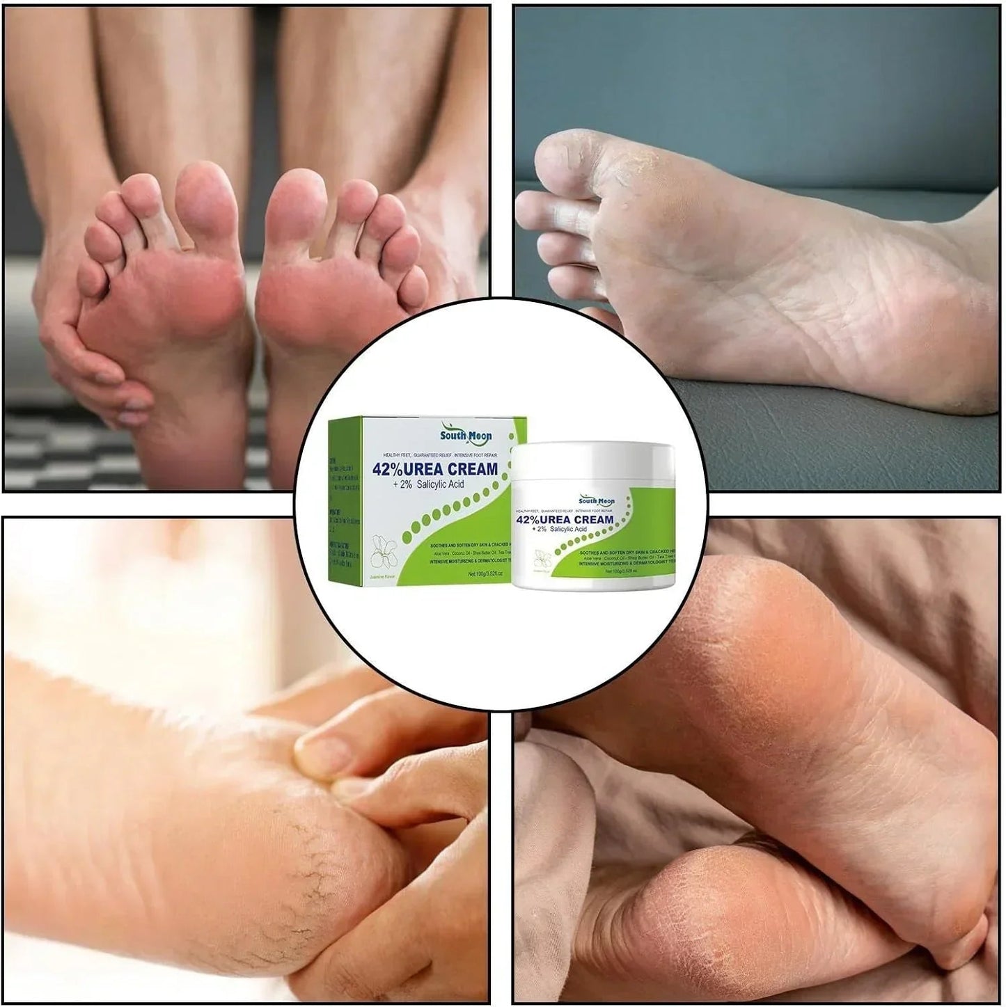 South Moon - 42% Urea Cream + 2% Salicylic Acid (Original) - Dar Al Emarat